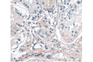 DAB staining on IHC-P Samples:Human Stomach Tissue) (APOA1 anticorps  (AA 122-267))
