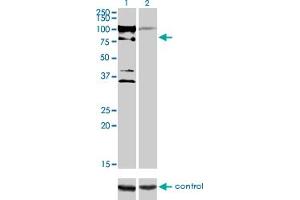 Western blot analysis of ZNF274 over-expressed 293 cell line, cotransfected with ZNF274 Validated Chimera RNAi (Lane 2) or non-transfected control (Lane 1). (ZNF274 anticorps  (AA 420-530))
