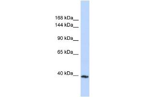 Host:  Rabbit  Target Name:  MYBPC3  Sample Type:  MCF7 Whole cell lysates  Antibody Dilution:  1. (MYBPC3 anticorps  (C-Term))