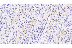 Detection of CYP2D6 in Human Kidney Tissue using Polyclonal Antibody to Cytochrome P450 2D6 (CYP2D6)