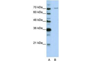 Western Blotting (WB) image for anti-PRP3 Pre-mRNA Processing Factor 3 Homolog (PRPF3) antibody (ABIN2462173) (PRPF3 anticorps)