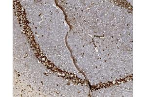 IHC analysis of FOXP1 using anti-FOXP1 antibody (ABIN7602780). (FOXP1 anticorps  (C-Term))