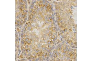 Immunohistochemistry (IHC) image for anti-Oxidized Low Density Lipoprotein (Lectin-Like) Receptor 1 (OLR1) (AA 58-273) antibody (ABIN1681162) (OLR1 anticorps  (AA 58-273))