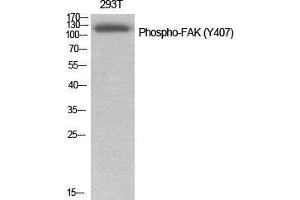 Western Blot (WB) analysis of specific cells using Phospho-FAK (Y407) Polyclonal Antibody.