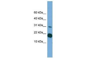 Western Blot showing IL1F5 antibody used at a concentration of 1-2 ug/ml to detect its target protein. (FIL1d anticorps  (Middle Region))