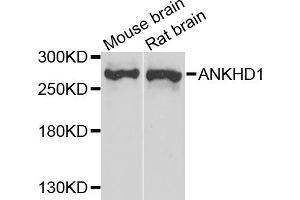 Western blot analysis of extracts of various cell lines, using ANKHD1 antibody (ABIN5974808) at 1/1000 dilution. (ANKHD1 anticorps)