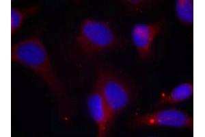 Immunofluorescence staining of methanol-fixed Hela cells using Zap-70(Phospho-Tyr319) Antibody. (ZAP7 (pTyr319) anticorps)