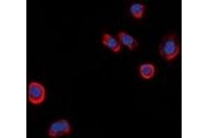 Immunofluorescent analysis of GPR101 staining in HeLa cells. (GPR101 anticorps  (C-Term))
