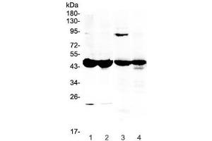 Western blot testing of 1) mouse testis, 2) mouse ovary, 3) rat stomach and 4) rat ovary lysate with Ada antibody at 0.