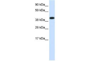 WB Suggested Anti-HSPA1A Antibody Titration:  1. (HSP70 1A anticorps  (Middle Region))