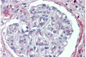 Human Kidney (formalin-fixed, paraffin-embedded) stained with PODXL antibody ABIN462244 followed by biotinylated goat anti-rabbit IgG secondary antibody ABIN481713, alkaline phosphatase-streptavidin and chromogen.