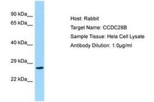 CCDC28B anticorps  (C-Term)