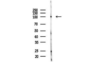 anti-Actinin, alpha 3 (ACTN3) (N-Term) antibody