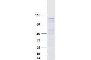 Validation with Western Blot
