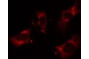 ABIN6274911 staining Hela cells by IF/ICC.