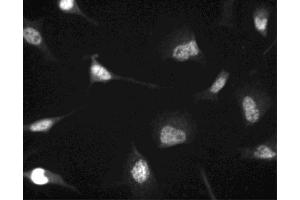 Immunofluorescent staining of HeLa (ATCC CCL-2) cells.