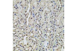 Immunohistochemistry of paraffin-embedded rat kidney using SMARCC2 antibody. (SMARCC2 anticorps  (AA 150-250))