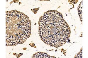ABIN7096215 and ABIN7100277 at 1/100 staining mouse testis tissue by IHC-P. (PTCD1 anticorps)