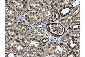 Image no. 3 for anti-RAB30, Member RAS Oncogene Family (RAB30) antibody (ABIN1500558)