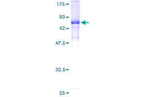 Image no. 1 for Jumonji Domain Containing 5 (JMJD5) (AA 1-416) protein (GST tag) (ABIN1308302)