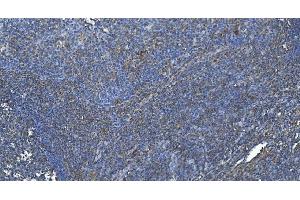 IHC analysis of DGKZ/DGK-zeta using anti-DGKZ/DGK-zeta antibody (ABIN7602261). (DGKZ anticorps  (AA 664-928))