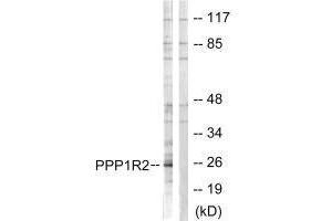 Western blot analysis of extracts from Jurkat cells, using PPP1R2 (Ab-120/121) antibody.