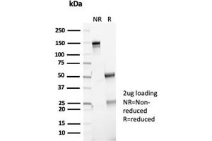 SDS-PAGE Analysis Purified P16INK4a Recombinant Rabbit Monoclonal (CDKN2A/7081R). (Recombinant CDKN2A anticorps)