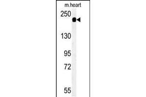 Western blot analysis of SAMD9L Antibody in mouse heart tissue lysates (35ug/lane)