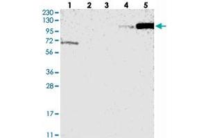 Western blot analysis of Lane 1: RT-4, Lane 2: U-251 MG, Lane 3: Human Plasma, Lane 4: Liver, Lane 5: Tonsil with ANKRD44 polyclonal antibody . (ANKRD44 anticorps)