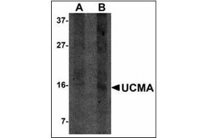 Western blot analysis of UCMA in SW1353 cell lysate with UCMA antibody at (A) 2. (UCMA anticorps  (C-Term))