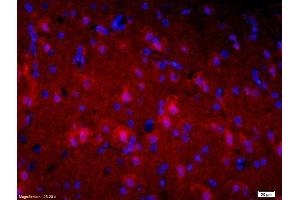 Formalin-fixed and paraffin-embedded rat brain labeled with Mouse Anti-Alpha-Synuclein Polyclonal Antibody, Unconjugatedused at 1:200 dilution for 40 minutes at 37°C. (Alpha, beta Synuclein (AA 122-140) anticorps)