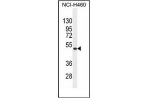 Western blot analysis of FNDC8 Antibody (Center) in NCI-H460 cell line lysates (35ug/lane).