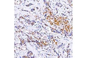 IHC analysis of Rab4/RAB4A using anti-Rab4/RAB4A antibody (ABIN7599733). (Rab4 anticorps  (AA 110-216))