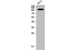 Western Blot analysis of Hela cells using Phospho-EphB1/2 (Y594/604) Polyclonal Antibody
