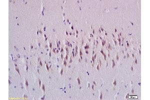 Formalin-fixed and paraffin embedded rat brain tissue labeled with Anti-Rab24 Polyclonal Antibody, Unconjugated (ABIN750373) at 1:200 followed by conjugation to the secondary antibody and DAB staining (RAB24 anticorps  (AA 1-100))