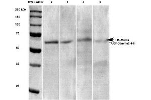 Western Blot analysis of Rat brain lysates showing detection of Stargazin Calcium Channel protein using Mouse Anti-Stargazin Calcium Channel Monoclonal Antibody, Clone S245-36 . (Stargazin anticorps  (AA 203-323) (FITC))