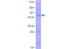 Image no. 1 for Claudin 18 (CLDN18) (AA 1-261) protein (GST tag) (ABIN1349600)