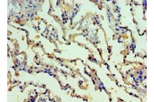 Immunohistochemistry of paraffin-embedded human lung tissue using ABIN7155522 at dilution of 1:100 (SMYD1 anticorps  (AA 1-350))