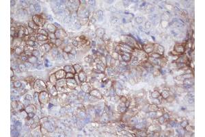 Image no. 1 for anti-Melanoma Antigen Family B, 18 (MAGEB18) antibody (ABIN1499274) (MAGEB18 anticorps)