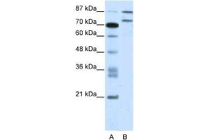 Human Jurkat; WB Suggested Anti-ZNF709 Antibody Titration: 2. (ZNF709 anticorps  (N-Term))