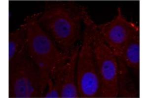 Image no. 1 for anti-Synuclein, alpha (SNCA) (pTyr133) antibody (ABIN401574) (SNCA anticorps  (pTyr133))