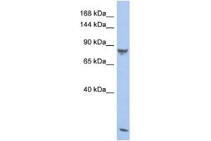 Western Blotting (WB) image for anti-phosphodiesterase 6A, CGMP-Specific, Rod, alpha (PDE6A) (N-Term) antibody (ABIN2786520)