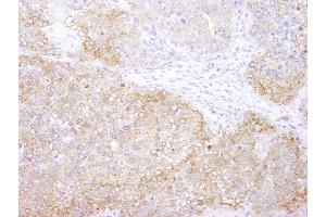 Immunohistochemistry (IHC) image for anti-Eukaryotic Elongation Factor-2 Kinase (EEF2K) (AA 675-725) antibody (ABIN7448957) (EEF2K anticorps  (AA 675-725))
