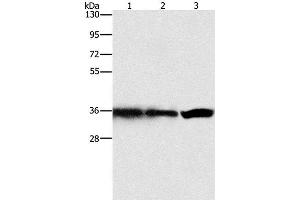 Western Blot analysis of Hela, 293T and 231 cell using GNB1 Polyclonal Antibody at dilution of 1:450 (GNB1 anticorps)