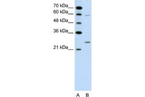 Western Blotting (WB) image for anti-Guanidinoacetate N-Methyltransferase (GAMT) antibody (ABIN2462453) (GAMT anticorps)