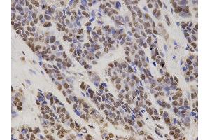 Immunohistochemistry (IHC) image for anti-Hepatoma-Derived Growth Factor (HDGF) antibody (ABIN1876535) (HDGF anticorps)