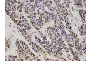 Immunohistochemistry (IHC) image for anti-Hepatoma-Derived Growth Factor (HDGF) antibody (ABIN1876535)