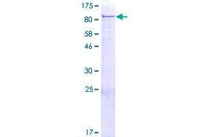 Image no. 1 for Protein Kinase C, beta (PRKCB) (AA 1-671) protein (GST tag) (ABIN1316257)