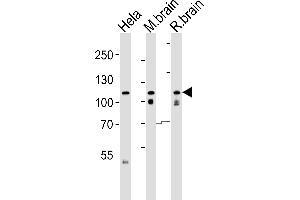 Western blot analysis of lysates from Hela cell line , mouse brain and rat brain tissue lysate(from left to right), using O(form S1) Antibody (C-term) (ABIN6242468 and ABIN6577502). (OPA1 (Form S1) (AA 895-929), (C-Term) anticorps)