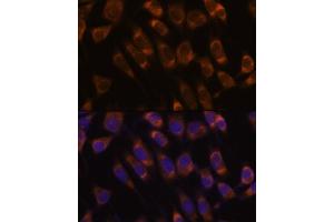 Immunofluorescence analysis of L929 cells using SEC61B antibody (ABIN7270173) at dilution of 1:100. (SEC61B anticorps  (AA 1-96))